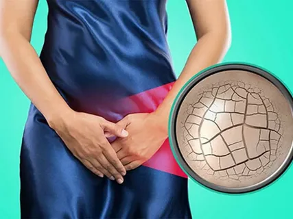 Vaginal Dryness: 9 Proven Non-Hormonal Solutions